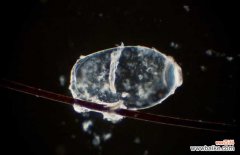 虱子卵可以用醋洗头去除吗 用醋能让虱子卵脱落吗？