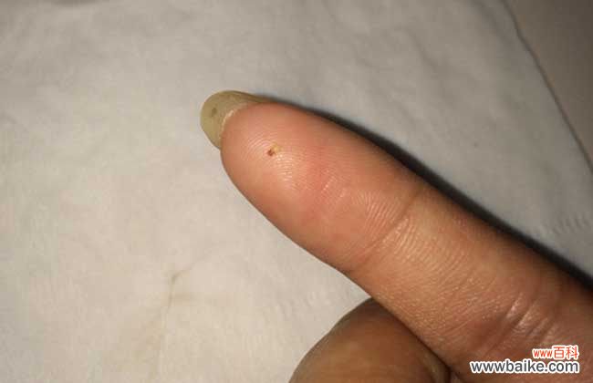 怎样判断身上有无跳蚤 跳蚤怕什么东西？